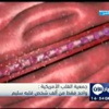 جمعية القلب الأمريكية :واحد فقط من ألف شخص قلبه سليم