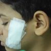 مصاريف المدرسة 8 آلاف جنيه.. مأساة تشويه وجه طفل داخل مدرسة خاصة بالجيزة مصاريف المدرسة 8 آلاف جنيه.. مأساة تشويه وجه طفل داخل مدرسة خاصة بالجيزة