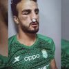 مدافع الاتحاد السكندري يغيب 6 أسابيع بسبب كسر الأنف