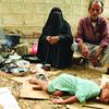 انخفاض الواردات واستمرار الصراع يفاقمان مجاعة اليمن انخفاض الواردات واستمرار الصراع يفاقمان مجاعة اليمن