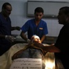 شهيدان متأثرين بجراحهما في غزة