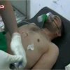 شاهدان يؤكدان استخدام سوريا أسلحة كيمياوية