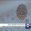 منظمة الصحة العالمية تشكو نقص التمويل لمكافحة السل في العالم
