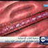 جمعية القلب الأمريكية :واحد فقط من ألف شخص قلبه سليم جمعية القلب الأمريكية :واحد فقط من ألف شخص قلبه سليم