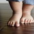 طفلي يعرج. ماذا أفعل؟ طفلي يعرج. ماذا أفعل؟