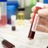 كورونا يغلق أبواب أوروبا