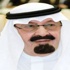 خادم الحرمين يأمر برعاية فصل التوأم عبدالله وسلمان