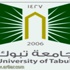 جامعة تبوك : استمرار استقبال طلبات التحديث في الفرز الثاني