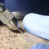 زراعة شعر اللحية.. جديد عمليات التجميل