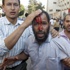 مصر: 100 مصاب في اشتباكات ميدان التحرير