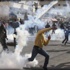 إصابة 20 فلسطينيا في مواجهات مع الاحتلال بالضفة إصابة 20 فلسطينيا في مواجهات مع الاحتلال بالضفة