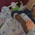 زياد العطار.. أمل بعد ان حولته شاحنته الى اشلاء