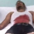 تعرض صحفى لمحاولة قتل وقطع شرايين يديه لسرقته بالإكراه بالوايلى تعرض صحفى لمحاولة قتل وقطع شرايين يديه لسرقته بالإكراه بالوايلى