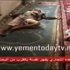 مئات الضحايا بتفجيرات صنعاء وبتوقيع تنظيم الدولة