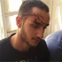 مستوطنون يعتدون على شابين مقدسيين والشرطة تعتقلهما