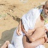 يحمل نصف أخيه على جسده 60 عاماً