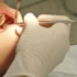 سويدي يفر من السجن ليذهب إلى طبيب الأسنان