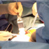 رجل من نيوجيرزي ينجو من مسمار بطول عشرة سنتيمترات في القلب رجل من نيوجيرزي ينجو من مسمار بطول عشرة سنتيمترات في القلب