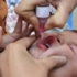 إطلاق الجرعة الثانية من حملة التطعيم ضد شلل الأطفال